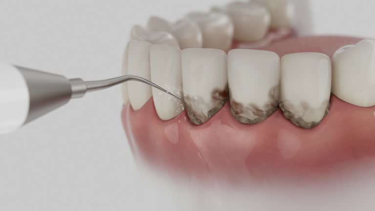 Trusted Dental Implants service in Red Boiling Springs, TN - Dentist Open Now